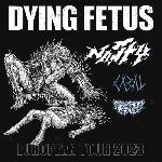 Dying Fetus